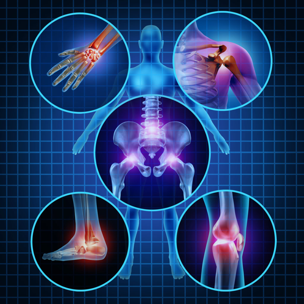 Arthritis Doctor Pottstown, PA Premier Osteoarthritis Centers of